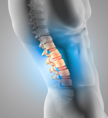 Digital illustration of a human spine with highlighted areas in orange and blue, designed for home decor, indicating different levels of spinal degeneration or pain.