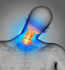 Digital illustration highlighting cervical spine inflammation in the neck with a heat-effect color gradient for home improvement purposes.