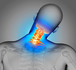 Anatomical illustration showing a human neck with highlighted cervical vertebrae to indicate pain or a medical condition following procedures.