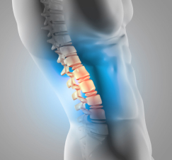 Illustration showing a side view of a human spine with highlighted lumbar vertebrae in orange, representing pain or injury, set against a gray background as part of our medical diagnostic procedures.