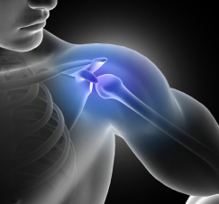 Digital medical illustration highlighting human shoulder pain with a focus on the shoulder joint and associated procedures.