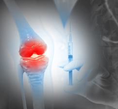 A stylized medical-themed image depicting a close-up view of inflamed knee joints with a background featuring a syringe, potentially symbolizing medical procedures or treatment for joint pain or arthritis.