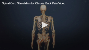 An educational videos thumbnail showcasing a human skeleton with a focus on the spine, titled "spinal cord stimulation for chronic back pain video.