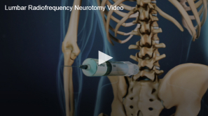 An educational video content still showing a syringe approaching the lumbar spine, illustrating a lumber radiofrequency neurotomy procedure.