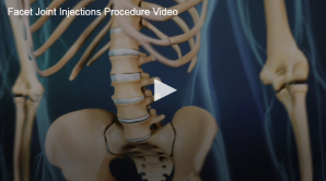 Anatomy illustration showing the spine and pelvis, with an overlay of a play button indicating a video content about facet joint injections procedure.