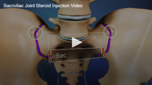An instructional online video thumbnail depicting the sacroiliac joint between the spine and pelvis, highlighting the area for a steroid injection procedure.