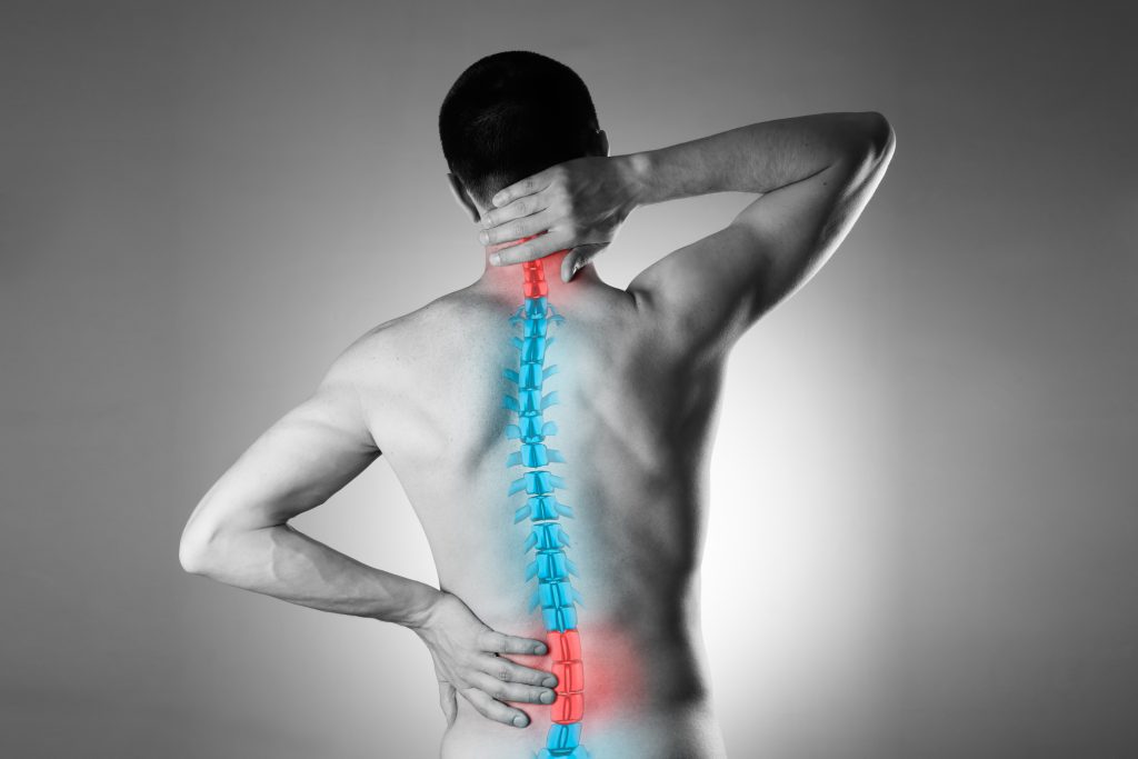 A man holding his neck and lower back, with a graphical illustration highlighting the spine in blue and areas of discomfort in red, suggesting pain or stiffness in those regions potentially requiring Trans Lateral Interbody Fusion
