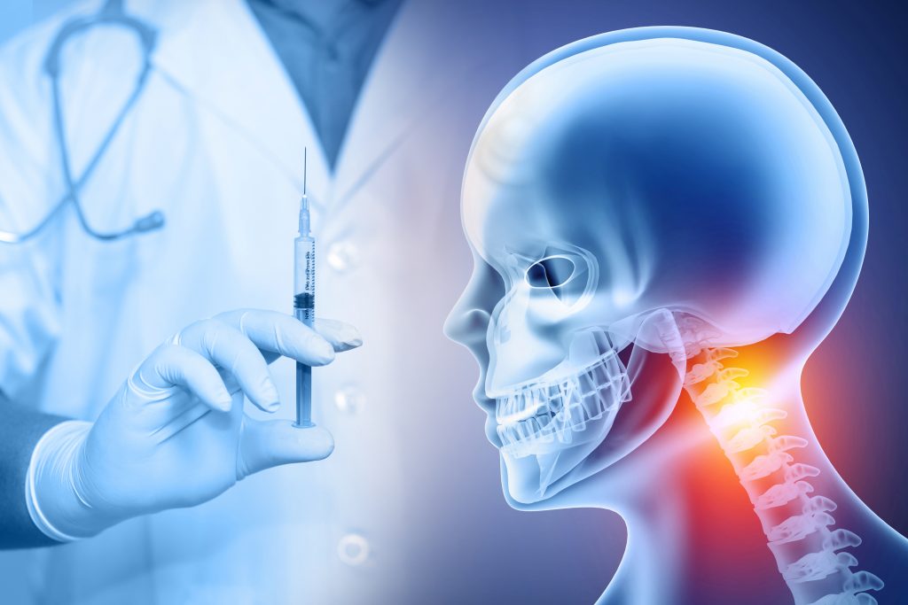 Digital composite image of a medical professional in a lab coat holding a syringe alongside a transparent anatomical illustration of a human skull, suggesting a focus on Epidural Steroid Injections related to cranial