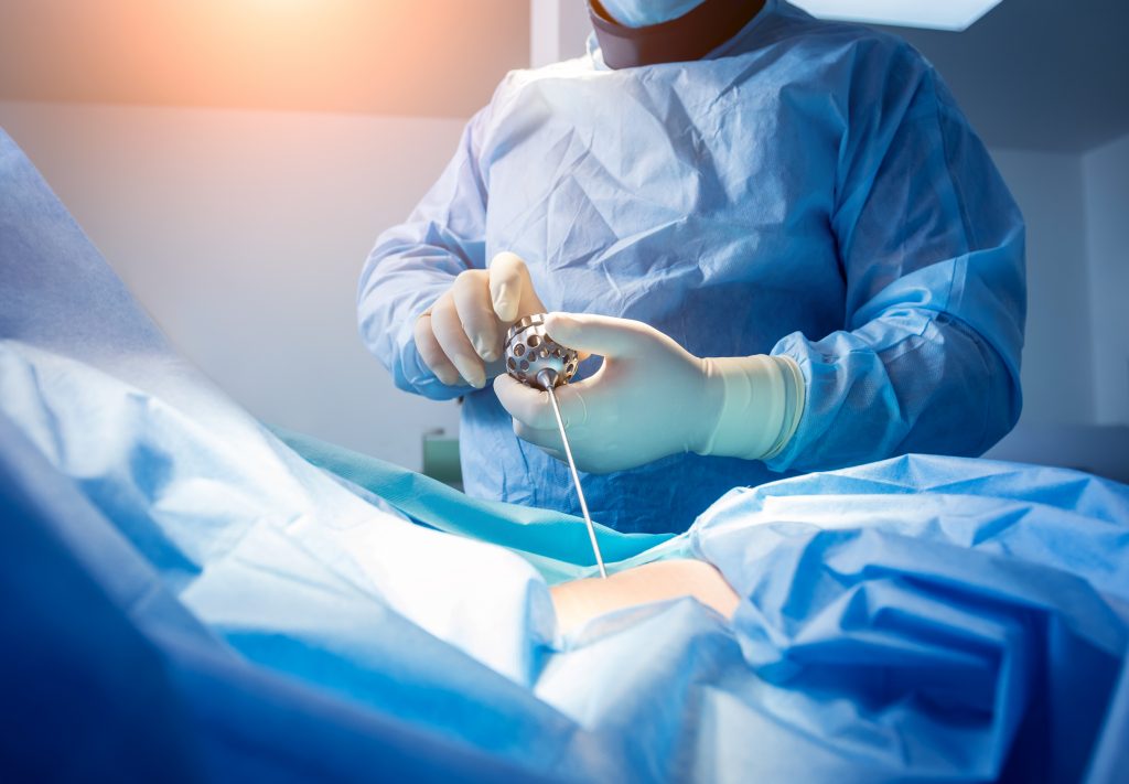 A surgeon in blue scrubs performs a microdiscectomy, focusing intently on the task at hand with surgical instruments. Blurred background of an operating room with a hint of warm light.