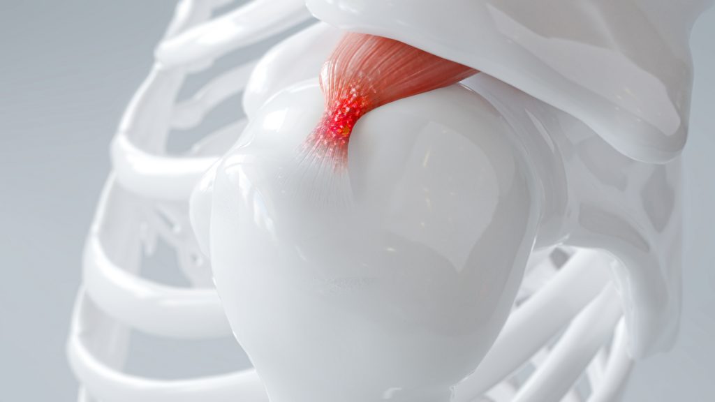 A detailed 3D rendering of a human shoulder joint, ideal for those preparing for shoulder surgery. The image focuses on the anatomy, showing a white, glossy skeletal structure and a close-up of muscle insertion on the humerus bone, highlighting the red muscle fibers connecting to the bone.