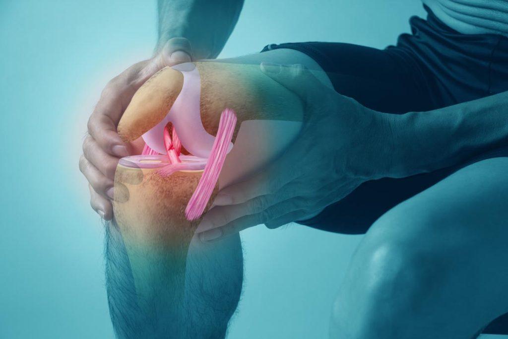Medical illustration of an ACL knee injury with highlighted ligaments and athlete holding their knee during pain