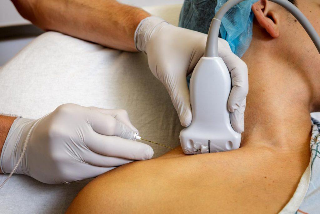 Doctor performing an ultrasound-guided nerve block injection procedure for pain relief and nerve-related discomfort management.
