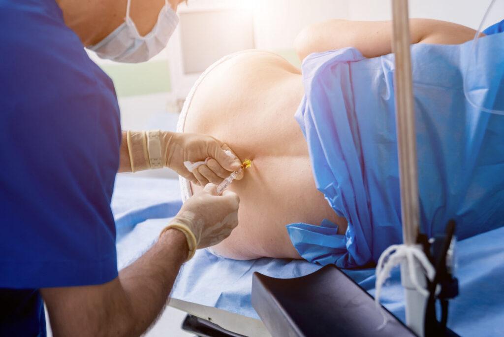 Medical professional performing a spinal injection procedure on a patient as part of a lower back pain treatment and spine pain management plan.